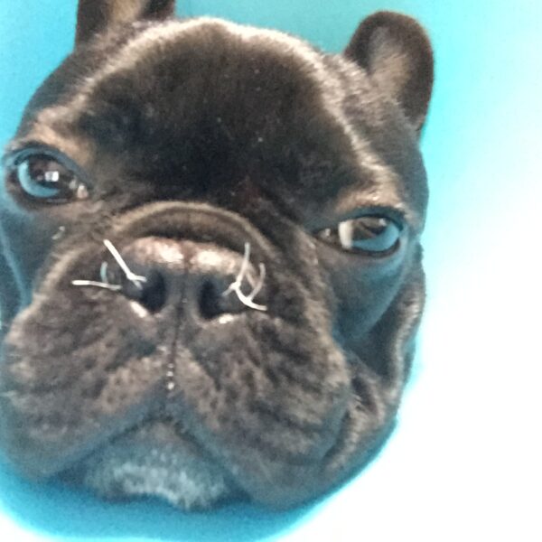 鼻腔狭窄手術とは?