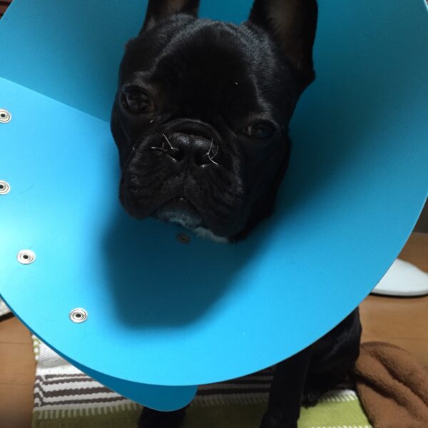 鼻腔狭窄（びくうきょうさく）とは？